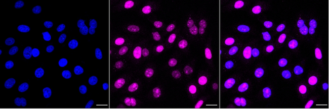 FGF2 Antibody in Immunocytochemistry (ICC/IF)