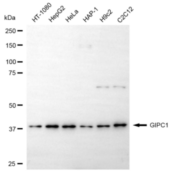 GIPC1 Antibody in Western Blot (WB)