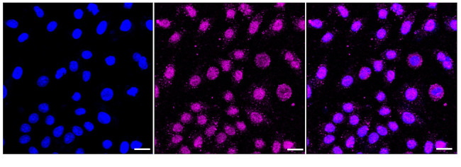 GTF2F2 Antibody in Immunocytochemistry (ICC/IF)