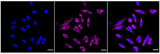 CECR5 Antibody in Immunocytochemistry (ICC/IF)