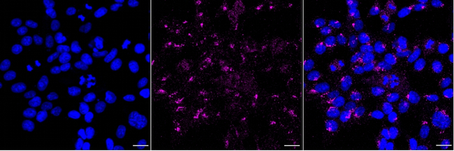 H-Ras Antibody in Immunocytochemistry (ICC/IF)