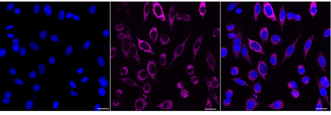 IGFBP7 Antibody in Immunocytochemistry (ICC/IF)