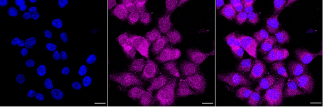 PPA1 Antibody in Immunocytochemistry (ICC/IF)