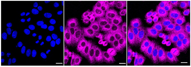 KLC1 Antibody in Immunocytochemistry (ICC/IF)