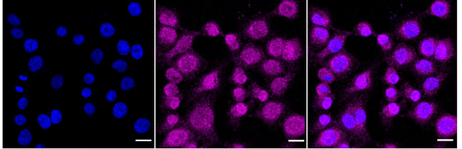 LRG1 Antibody in Immunocytochemistry (ICC/IF)