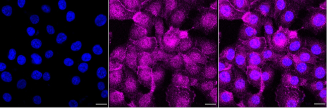 LAT Antibody in Immunocytochemistry (ICC/IF)