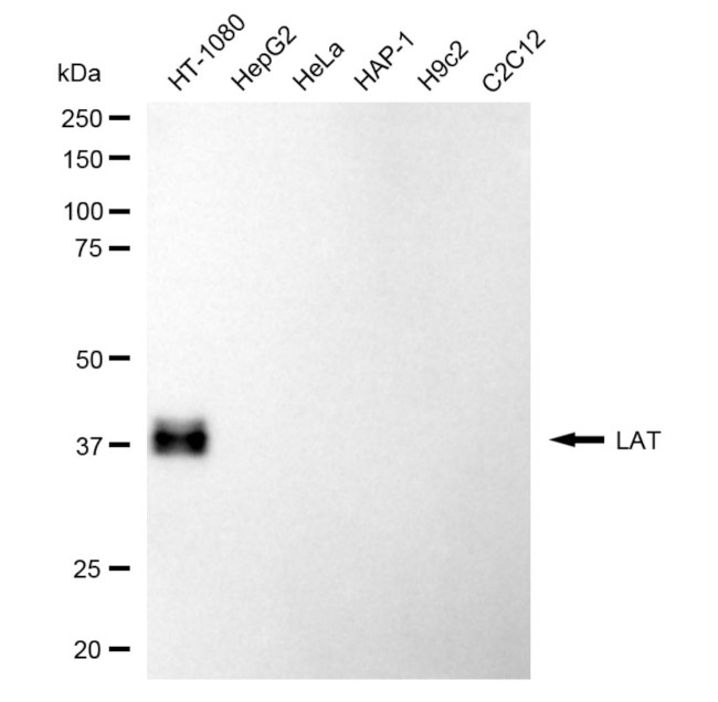 LAT Antibody in Western Blot (WB)
