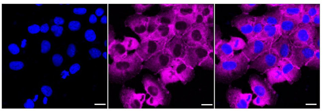 LPP Antibody in Immunocytochemistry (ICC/IF)