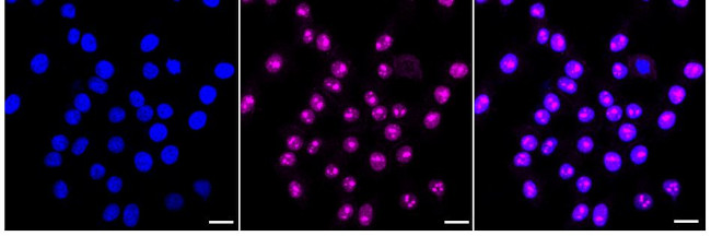 Lyn Antibody in Immunocytochemistry (ICC/IF)