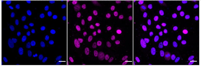 KDM1B Antibody in Immunocytochemistry (ICC/IF)