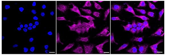 MADD Antibody in Immunocytochemistry (ICC/IF)
