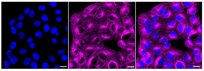 JNK3 Antibody in Immunocytochemistry (ICC/IF)