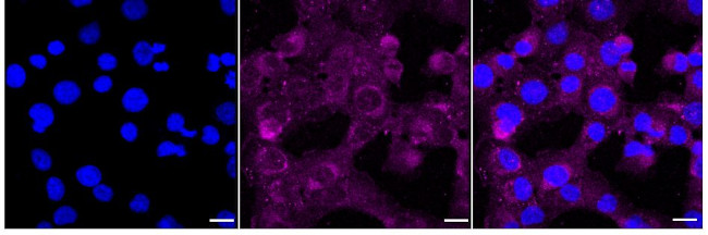 MARK2 Antibody in Immunocytochemistry (ICC/IF)