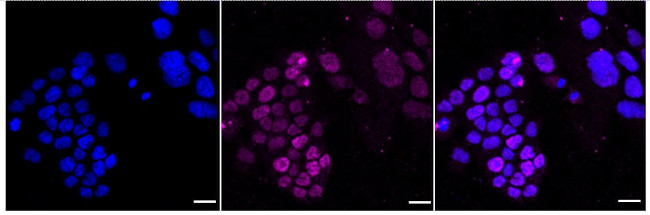 MATR3 Antibody in Immunocytochemistry (ICC/IF)