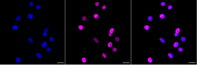 MTA2 Antibody in Immunocytochemistry (ICC/IF)