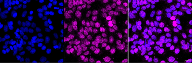 MBD1 Antibody in Immunocytochemistry (ICC/IF)