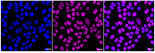 MBD2 Antibody in Immunocytochemistry (ICC/IF)