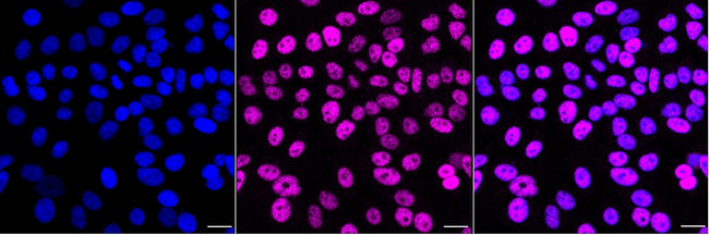 MBD2 Antibody in Immunocytochemistry (ICC/IF)