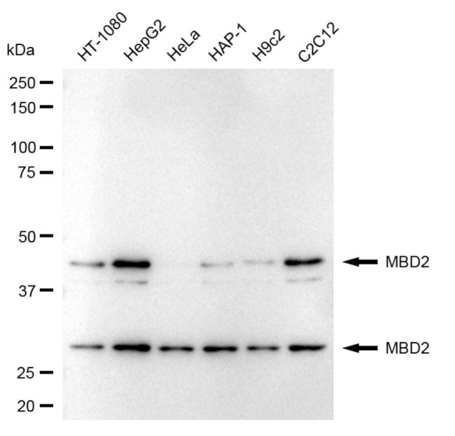 MBD2 Antibody in Western Blot (WB)