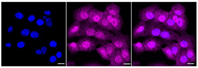 MVK Antibody in Immunocytochemistry (ICC/IF)