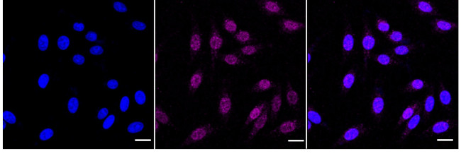 MLKL Antibody in Immunocytochemistry (ICC/IF)