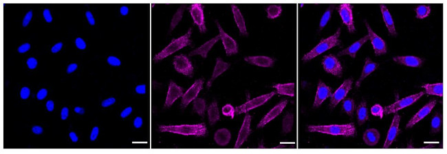 Moesin Antibody in Immunocytochemistry (ICC/IF)