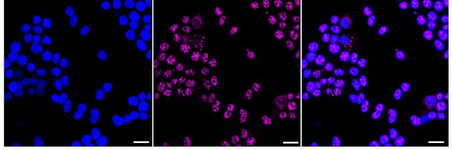 MOV10 Antibody in Immunocytochemistry (ICC/IF)