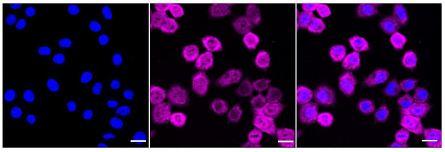 MSI2 Antibody in Immunocytochemistry (ICC/IF)
