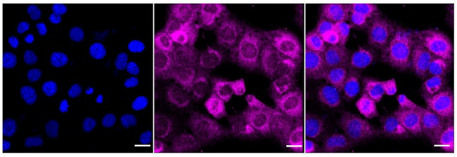 NQO1 Antibody in Immunocytochemistry (ICC/IF)