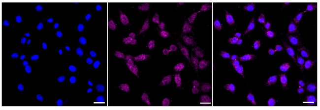 NDUFB9 Antibody in Immunocytochemistry (ICC/IF)
