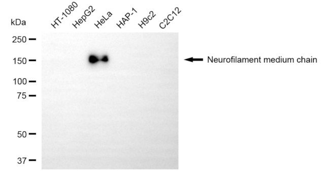 NEFM Antibody in Western Blot (WB)