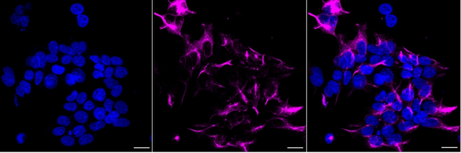 NEFM Antibody in Immunocytochemistry (ICC/IF)