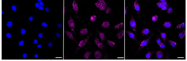 NLK Antibody in Immunocytochemistry (ICC/IF)