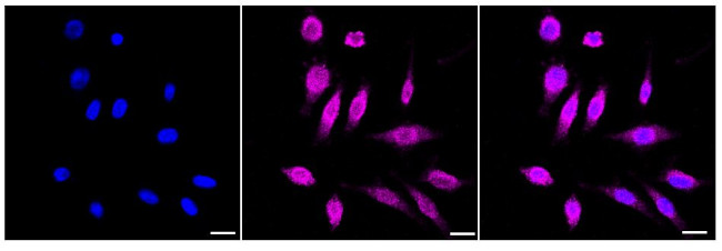 NCS1 Antibody in Immunocytochemistry (ICC/IF)