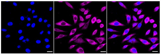 NCAPD2 Antibody in Immunocytochemistry (ICC/IF)