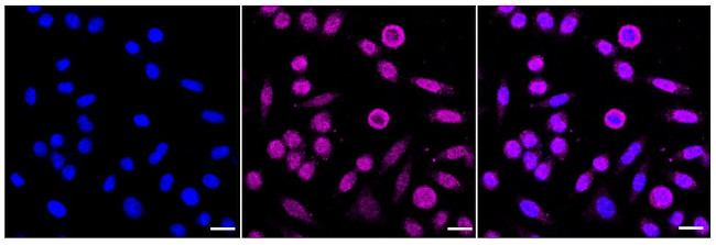 NQO2 Antibody in Immunocytochemistry (ICC/IF)