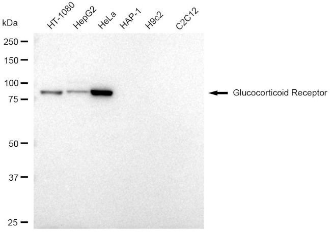 Glucocorticoid Receptor Antibody in Western Blot (WB)