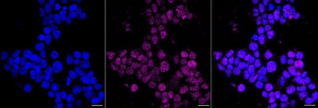 PDX1 Antibody in Immunocytochemistry (ICC/IF)