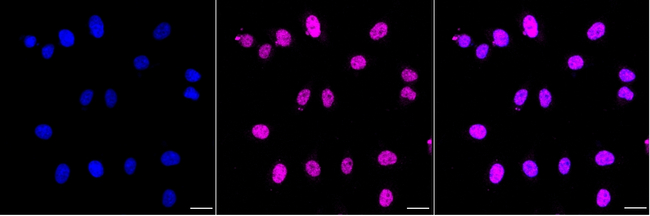 PCYT1A Antibody in Immunocytochemistry (ICC/IF)