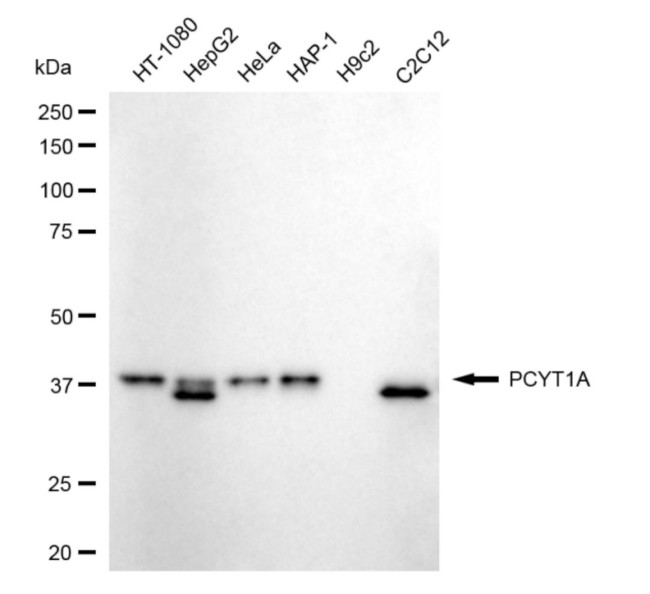 PCYT1A Antibody in Western Blot (WB)