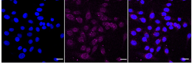 PDPK1 Antibody in Immunocytochemistry (ICC/IF)
