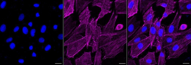 PDLIM1 Antibody in Immunocytochemistry (ICC/IF)