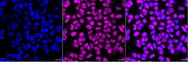 MNAR Antibody in Immunocytochemistry (ICC/IF)