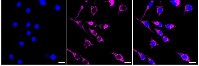 PRDX3 Antibody in Immunocytochemistry (ICC/IF)