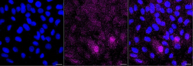 PRDX5 Antibody in Immunocytochemistry (ICC/IF)