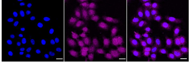 PRDX6 Antibody in Immunocytochemistry (ICC/IF)
