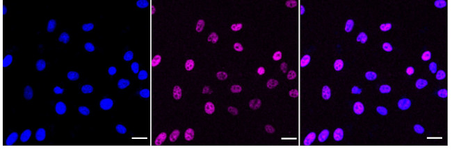 Phospho-HSF1 (Ser303, Ser307) Antibody in Immunocytochemistry (ICC/IF)