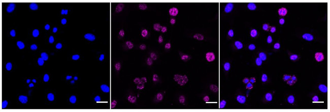Phospho-MEK1 (Thr292) Antibody in Immunocytochemistry (ICC/IF)