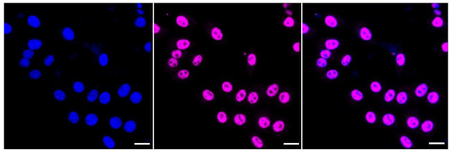 Phospho-mTOR (Ser2481) Antibody in Immunocytochemistry (ICC/IF)