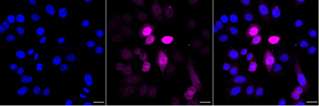 Phospho-NDRG1 (Ser330) Antibody in Immunocytochemistry (ICC/IF)